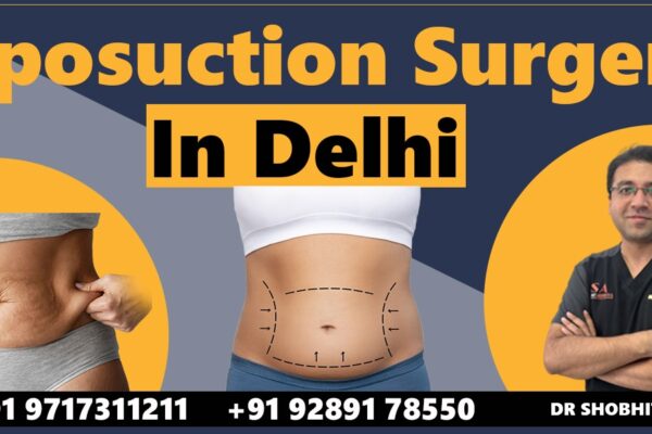 High-Definition Liposuction in Delhi: Sculpted Results Beyond Traditional Fat Removal