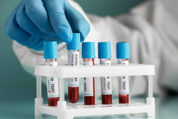 Blood Sample Collection from Home: A Convenient Solution for Your Health Needs