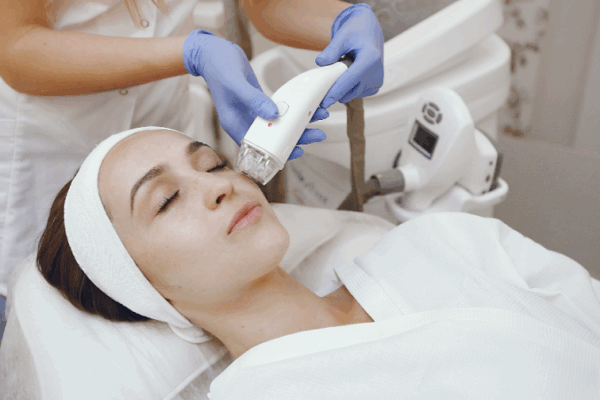 hifu face lift singapore