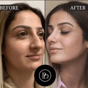Choosing the Best Plastic Surgeon in Dubai: What I Wish I Knew Sooner
